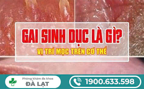 Hình ảnh minh họa